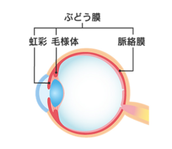 ぶどう膜炎