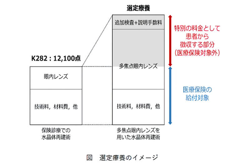 選定療養