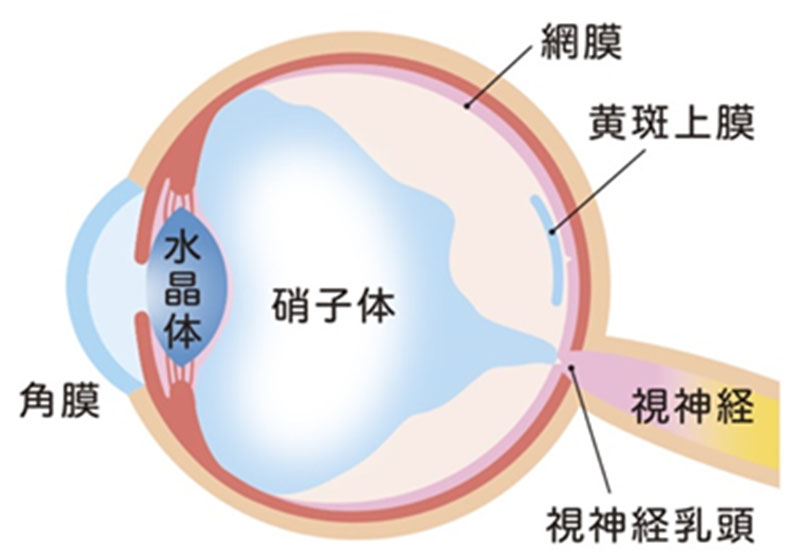 網膜硝子体手術とは