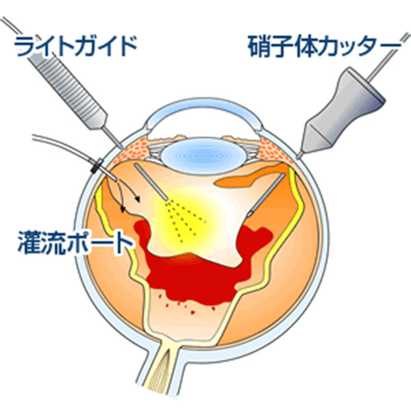 ポート作成