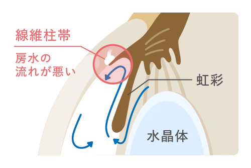 治療前