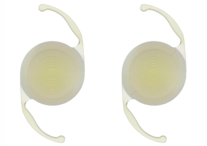 白内障手術で使うレンズの種類と特徴を解説|単焦点・多焦点・乱視矯正の違い