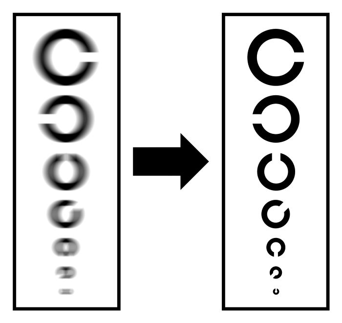 白内障手術後の視力回復はいつ？回復が遅くなる要因や安定させるためにできることについて解説