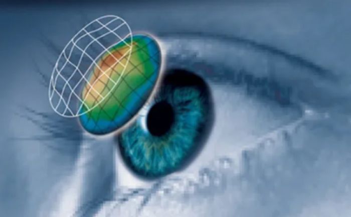 レーシックと白内障の関係とは？手術への影響・注意点・よくある疑問を総まとめ